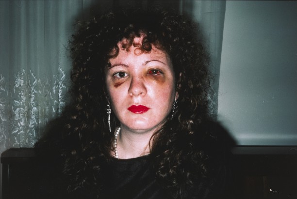 Nan after being battered
